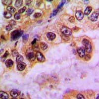 Polyclonal Rabbit anti-Human GABRD Antibody (Internal, IHC, WB)