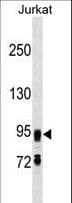 Polyclonal Rabbit anti-Human FIG4 Antibody (aa846-874, WB)