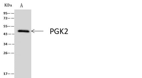 PGK2 Antibody (Preservative Free)