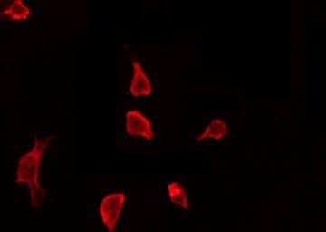 CTTN / Cortactin Antibody (phospho-Tyr466)