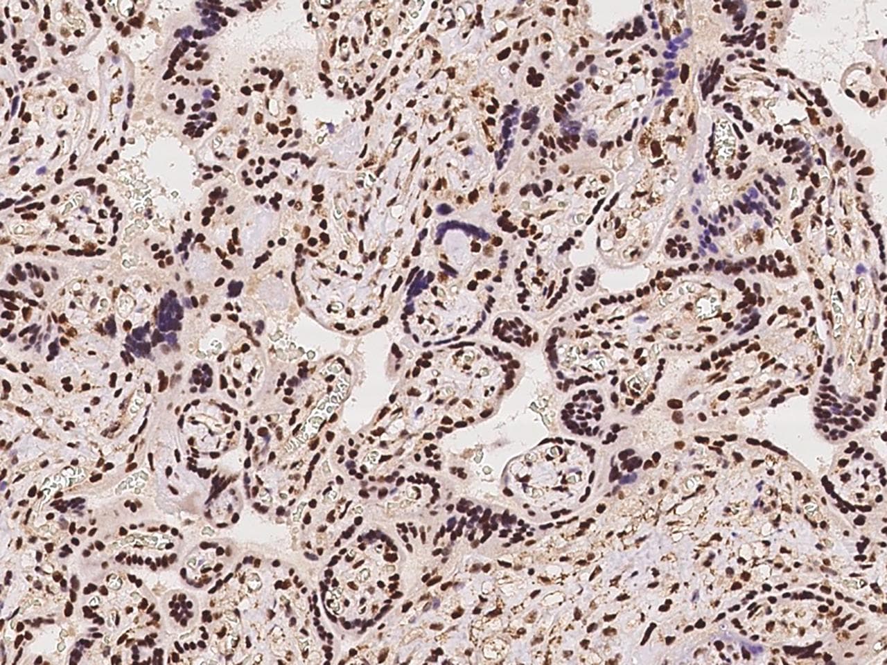 Polyclonal Rabbit anti-Human HSF1 Antibody (Preservative Free, IHC)