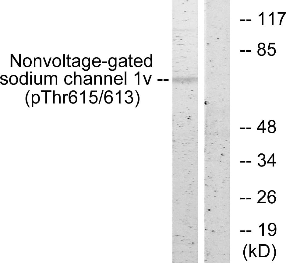 Polyclonal Rabbit anti-Human SCNN1B / ENaC Beta Antibody (phospho-Thr615, IHC, IF, WB)