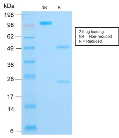 PathPlus™ KRT16 / CK16 / Cytokeratin 16 Antibody (C-Terminus, clone rKRT16/1714)