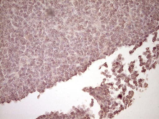 PLAT / TPA Antibody (aa157-426, clone OTI3H3, Carrier-free)