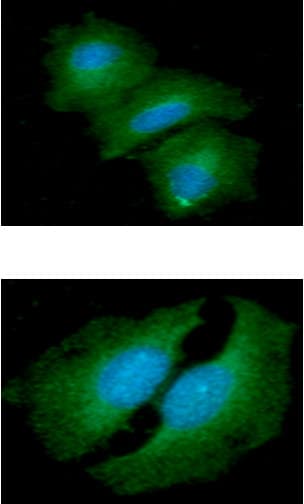 Monoclonal Mouse anti-Human TIP30 / HTATIP2 Antibody (clone AT5D6, WB)