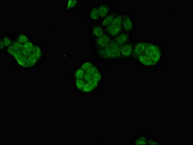Polyclonal Rabbit anti-Human PRDM16 Antibody (IHC, IF)