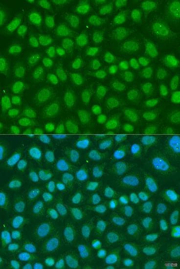 TAF11 Antibody