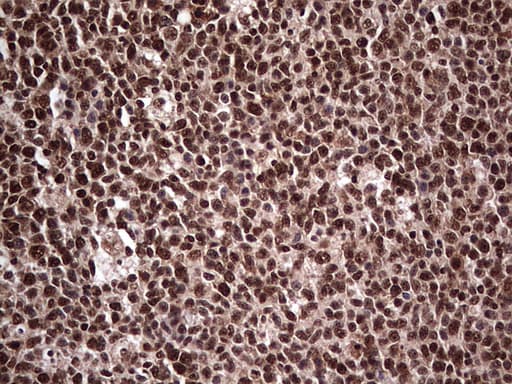 Monoclonal Mouse anti-Human SAE1 Antibody (clone OTI6B11, IHC, WB)