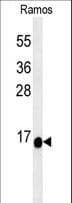 Polyclonal Rabbit anti-Human C1orf186 Antibody (aa121-150, IHC, WB)