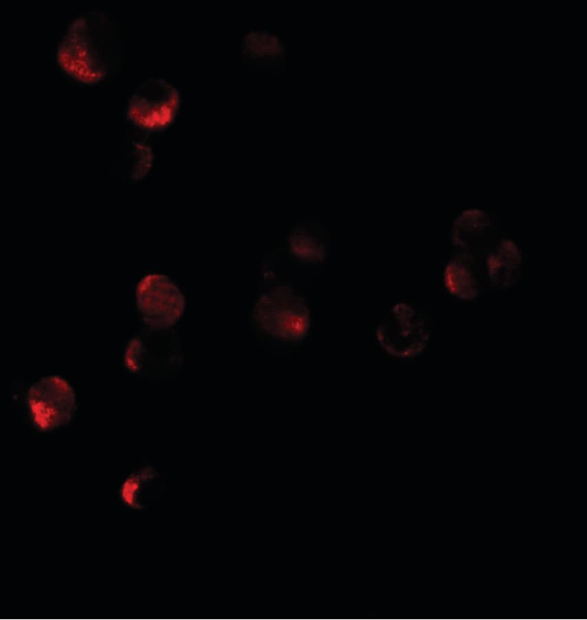 Polyclonal Rabbit anti-Human HIGD1A Antibody (IF, WB)