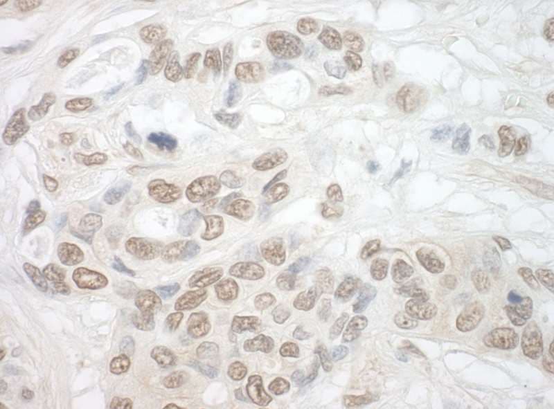 TDRD3 Antibody (aa601-651)