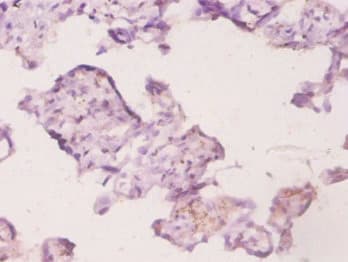 UBE2K / LIG Antibody