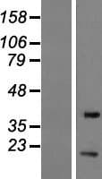 EIF1B Protein (Over-Expression Lysate Myc-DDK (Flag))