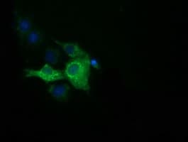 IGF2BP2 Antibody (clone OTI6C4)