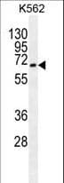 ATG16L2 Antibody (aa277-304)
