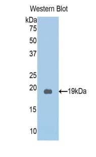 PKN2 Antibody (aa323-464, Biotin)