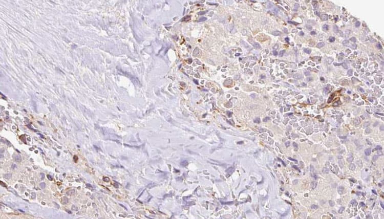 RIC8B Antibody