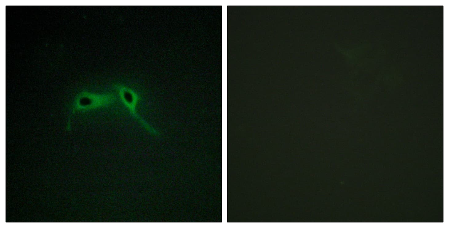 IHC-plus™ Neurofibromin / NF1 Antibody (aa1551-1600)