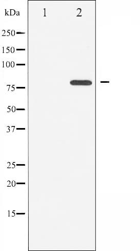 PRKCQ / PKC-Theta Antibody (phospho-Ser676)