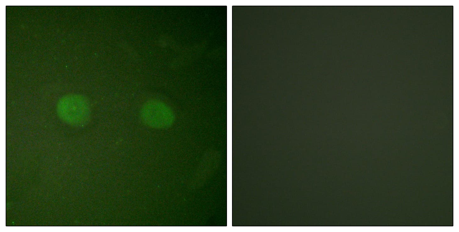 PPARA / PPAR Alpha Antibody (aa6-55)