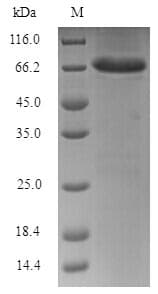 Junin mammarenavirus SARS-CoV Nucleoprotein (Recombinant 6His-SUMO, N-terminus)