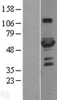 PFK2 / PFKFB3 Protein (Over-Expression Lysate Myc-DDK (Flag))