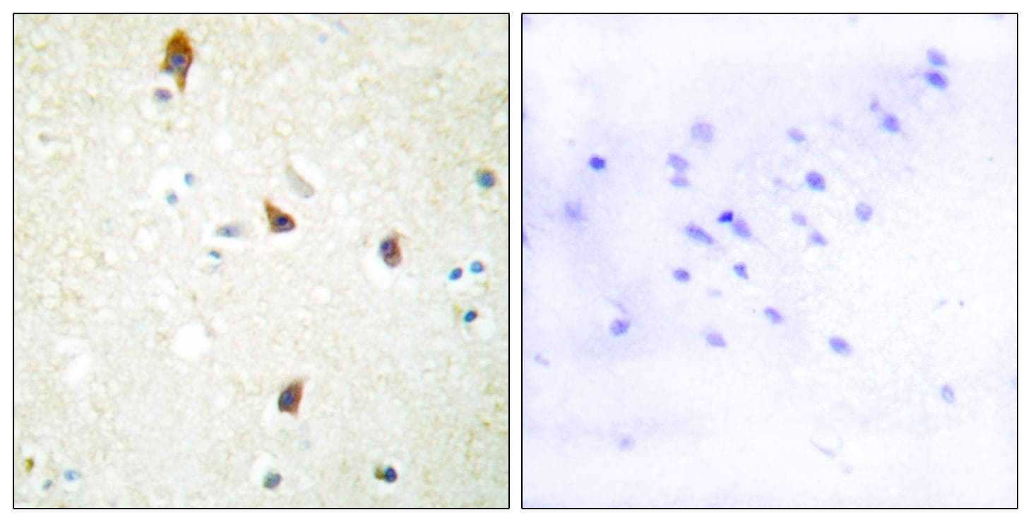 HTR2B / 5-HT2B Receptor Antibody