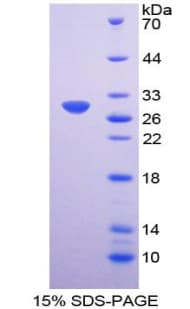Human FUT3 Protein (Recombinant His-T7)