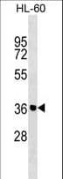 ZNF785 Antibody (aa1-30)