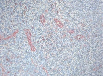 Alpha-1-Antichymotrypsin Antibody (clone ACT 14C7)