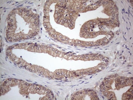 Monoclonal Mouse anti-Human MTF-1 Antibody (clone OTI2F3, aa1-272, IHC, WB)
