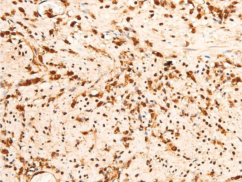 Polyclonal Rabbit anti-Human CHEK2 / CHK2 Antibody (phospho-Thr383, IHC, IF, WB)