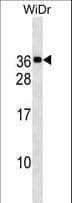 MED30 Antibody (aa107-133)