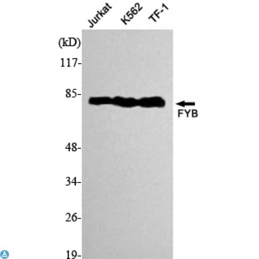 Monoclonal Mouse anti-Human ADAP / FYB Antibody (WB)