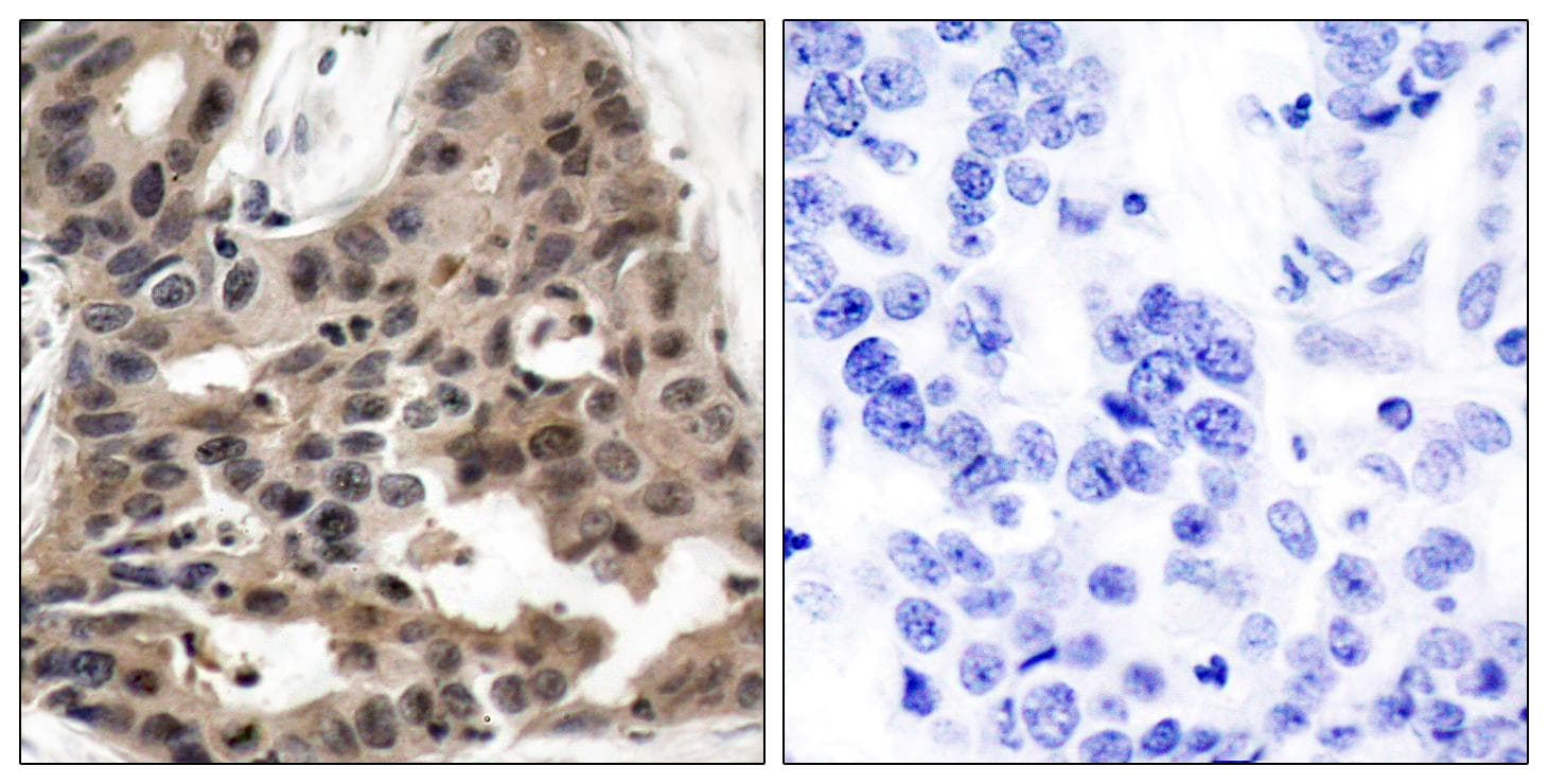 EIF4EBP1 / 4EBP1 Antibody (p36)