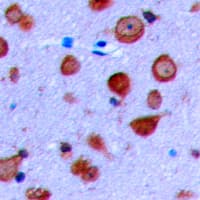 KCNJ11 / Kir6.2 Antibody (Internal)