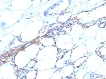 SMMHC / MYH11 Antibody (clone SPM201)
