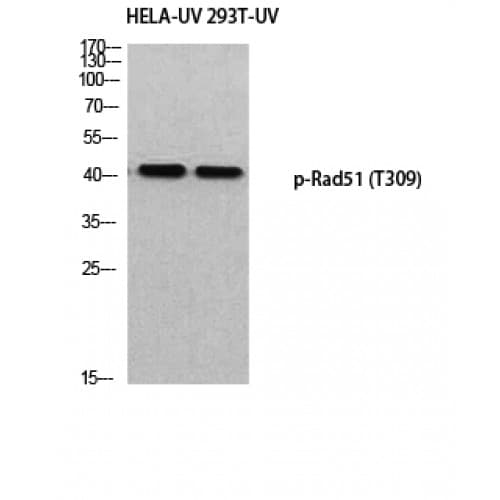 RAD51 / RECA Antibody (250-330 aa)