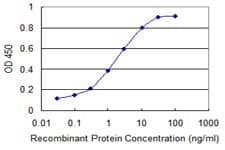 CHUK / IKKA / IKK Alpha Antibody (clone 4B8)