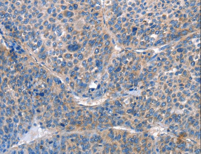 AKR1D1 Antibody