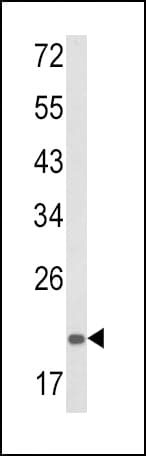 PSMA7 Antibody (aa100-126)