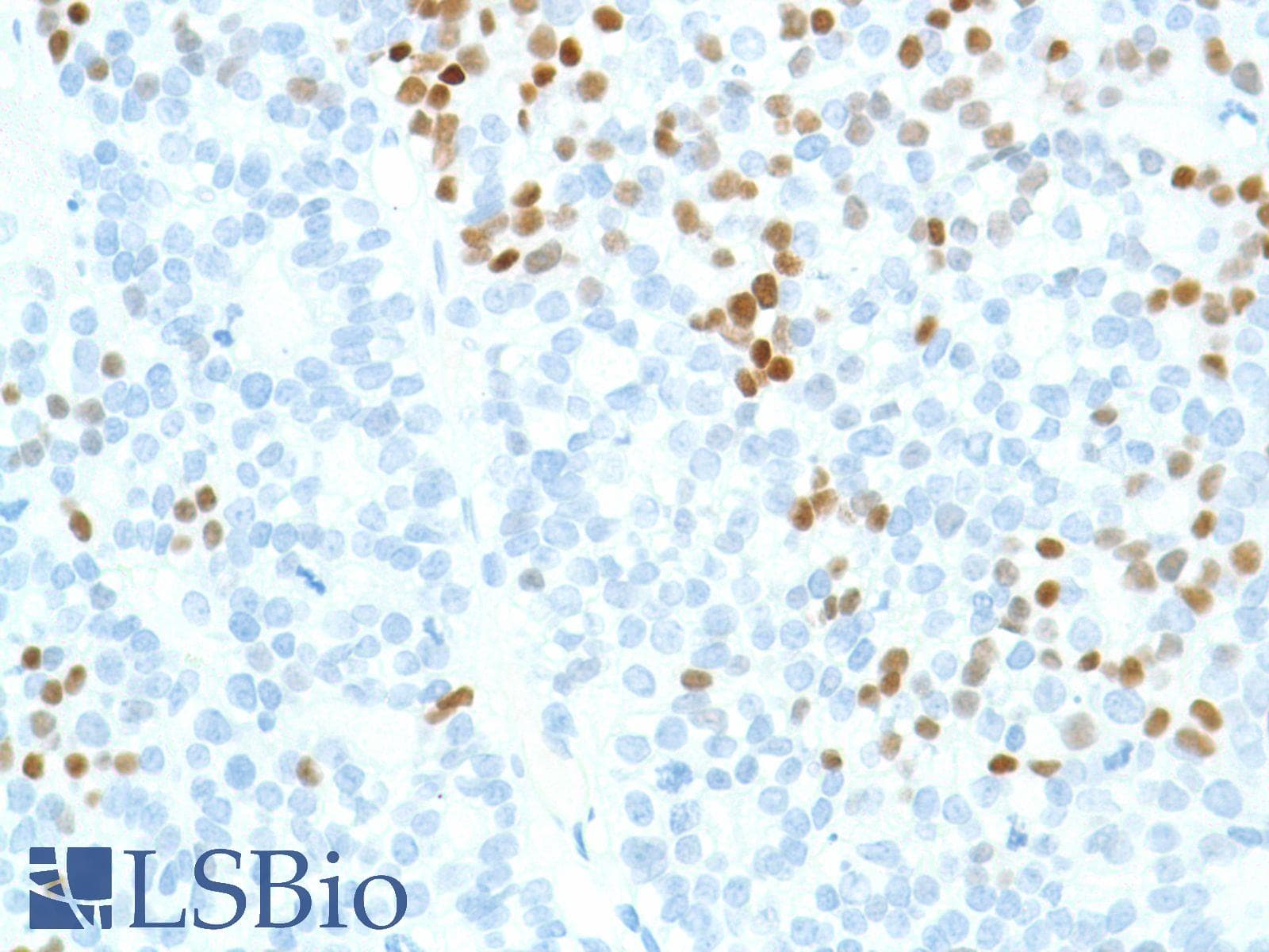 SOX2 Antibody (N-Terminus, clone SP76)