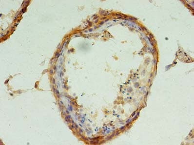 CHMP6 Antibody