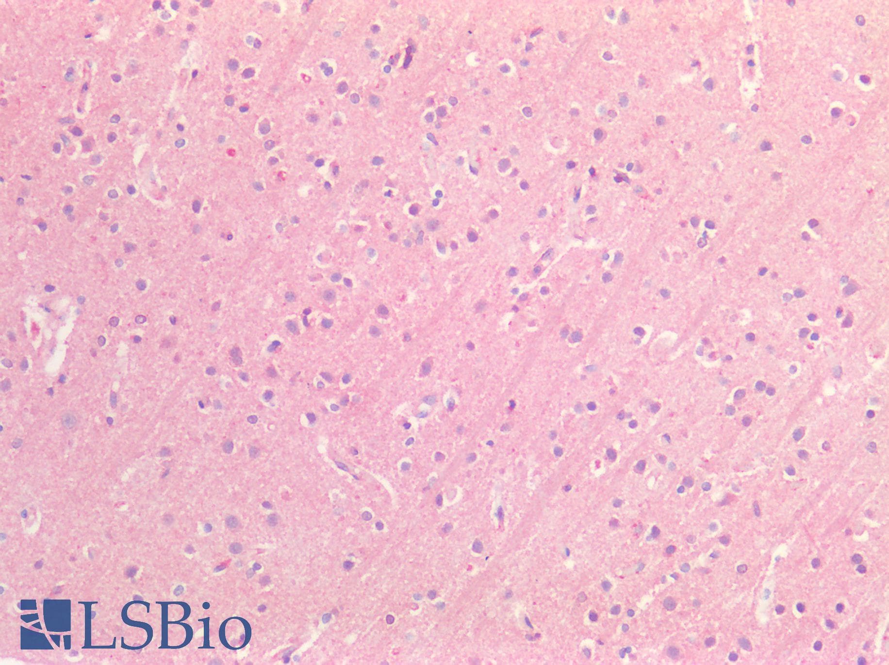 PathPlus™ Polyclonal Rabbit anti-Human APOE / Apolipoprotein E Antibody (IHC, IF)