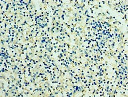 RSPO1 / RSPO Antibody (aa21-263)