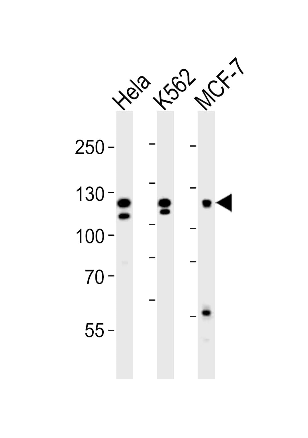 FGFR2 / FGF Receptor 2 Antibody (aa22-51)