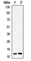 PHLDA2 / TSSC3 Antibody