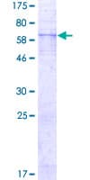 Human EDNRA / Endothelin A Receptor Protein (Recombinant GST)