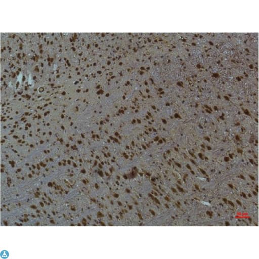 Monoclonal Mouse anti-Human CaMKII Beta+Gamma+Delta Antibody (IHC)