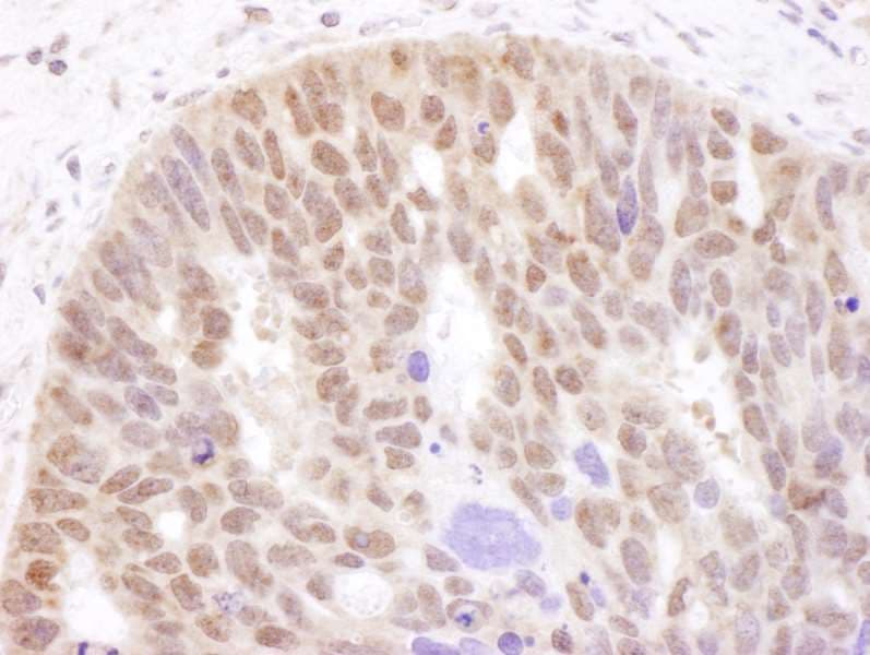 AR / Androgen Receptor Antibody (aa1-50)